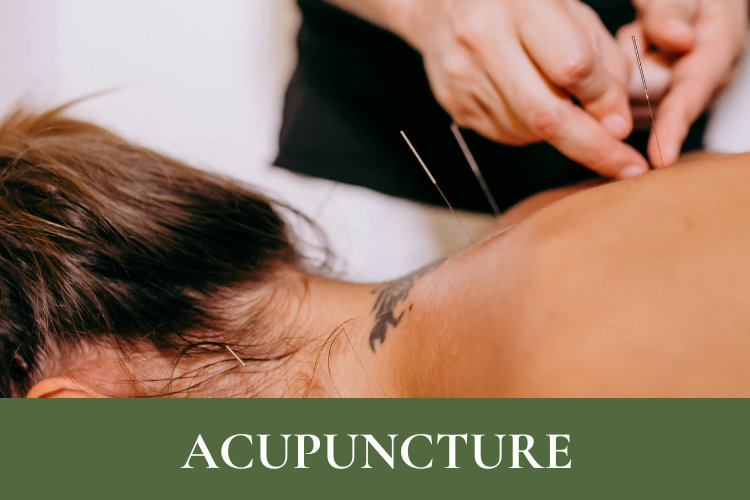 acupuncture service